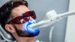 What are the Short-Term Side Effects or Risks of Teeth Whitening (and How to Manage Them) 