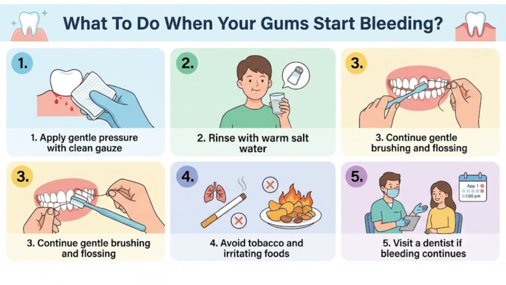 What to Do When Your Gums Start Bleeding